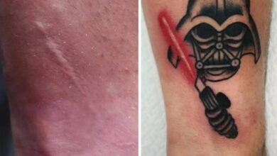 Photo of Искусство вместо шрама (14 фото)