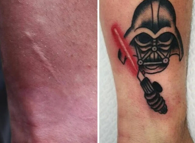 Photo of Искусство вместо шрама (14 фото)